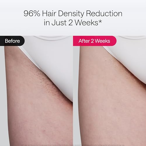 Laser Hair Removal Device with Ice Cool, Dual Lights, Skin Sensor & USHR Mode N94839