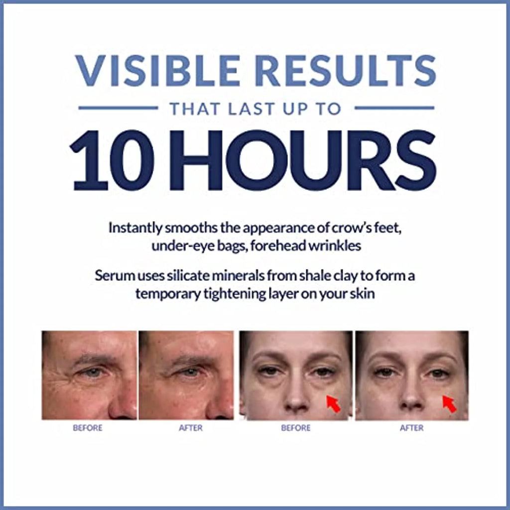 Rapid Reduction Eye Serum M7093