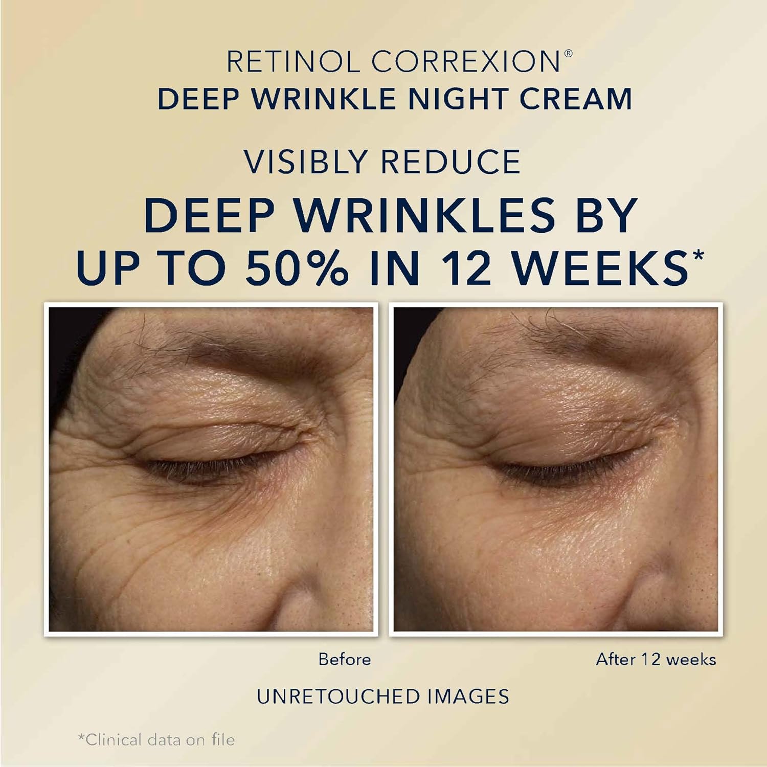 Retinol Correxion Deep Wrinkle Night Face Cream + Daily Under Eye Cream Skin Care Set W9789